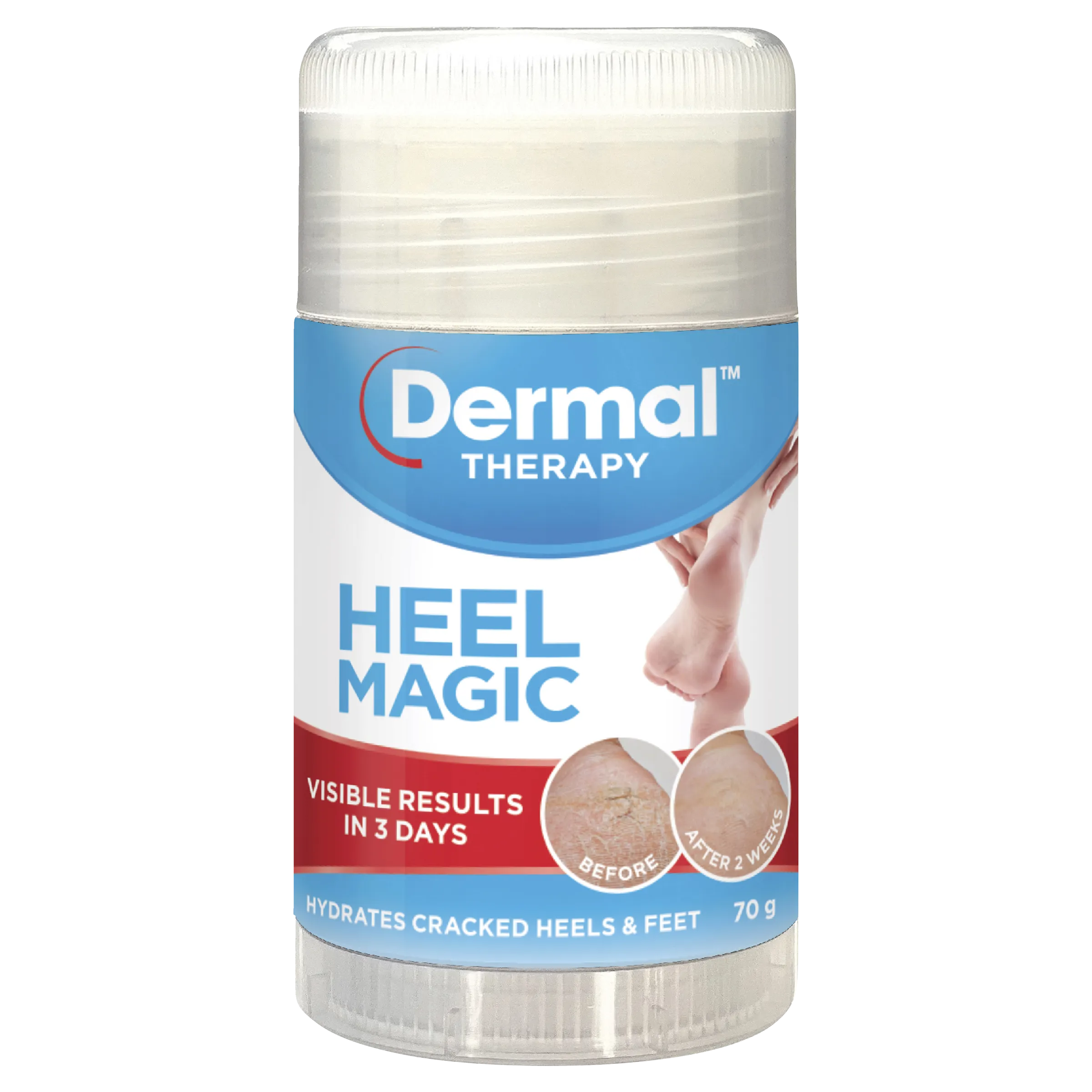 Dermal Therapy Heel Magic