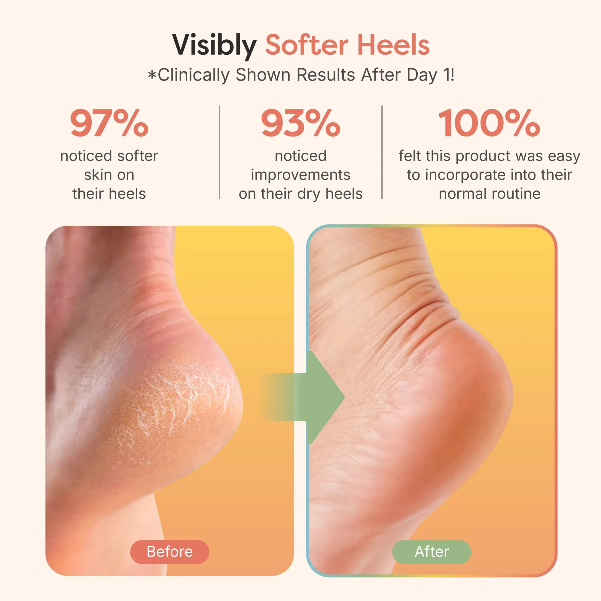 Moisturizing Gel Heel Socks - Fuzzy