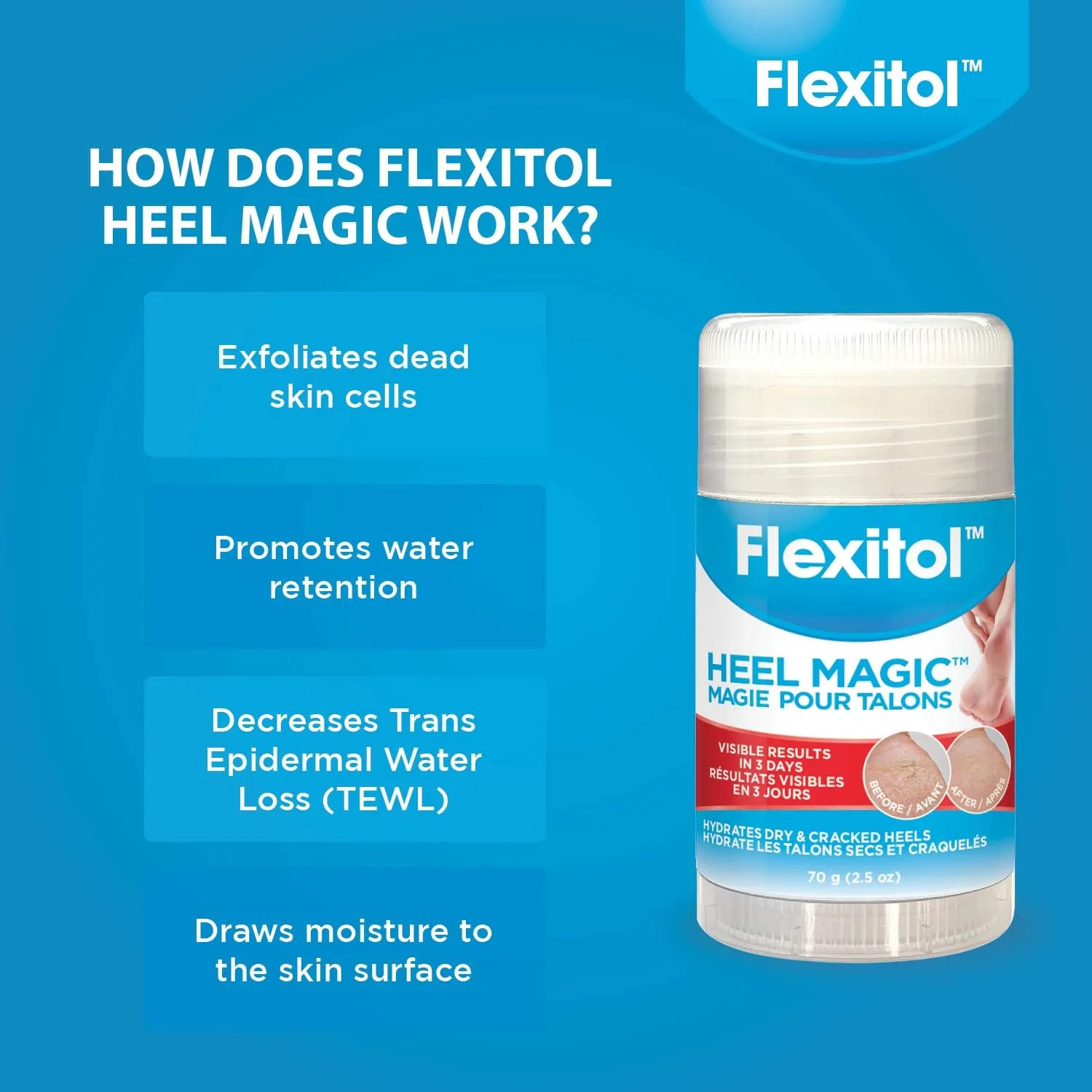 NEW Flexitol Heel Magic for Treating Cracked and Dry Heels (70g)